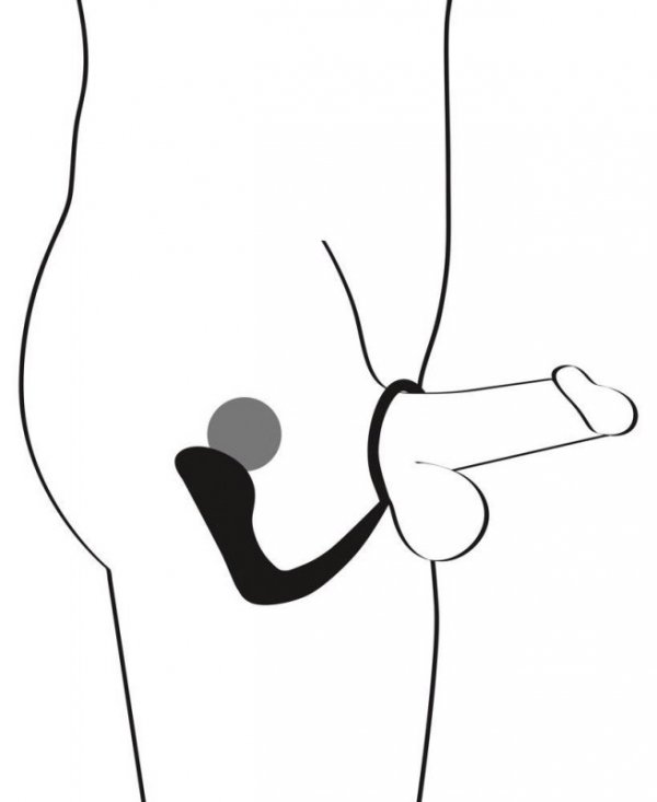 Plug-BV Ring &amp; Plug