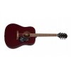 Epiphone Starling Acoustic Player Pack WR