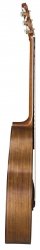 Baton Rouge AR31S/JC-AM Alex Misco Signature