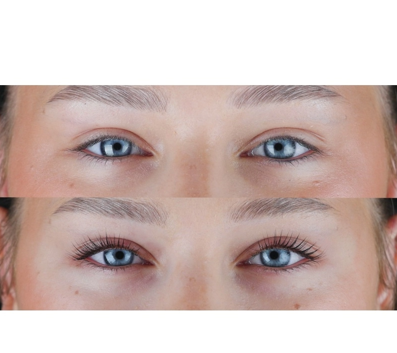 Lami Hydro Care - Step 3-4 saszetka 2ml RARITY