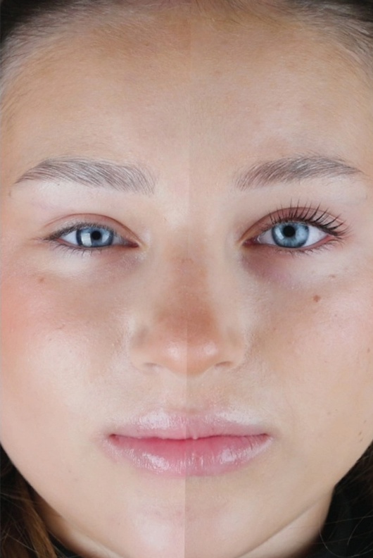 Rarity Hydro Care Step 3-4 (5ml)