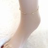 gold bracelet for a gold-plated leg