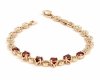 gold bracelet for a gold-plated leg