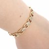gold bracelet for a gold-plated leg