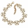 gold bracelet for a gold-plated leg