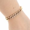 gold bracelet for a gold-plated leg
