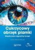 Cukrzycowy obrzęk plamki. Współczesne algorytmy terapii