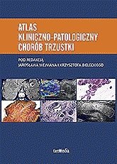 Atlas kliniczno-patologicz<br />ny chorób trzustki 