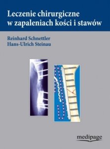 Leczenie chirurgiczne w zapaleniach kości i stawów