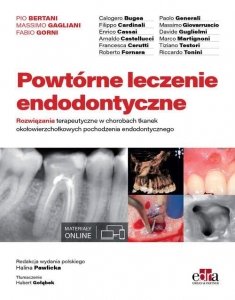 Powtórne leczenie endodontyczne