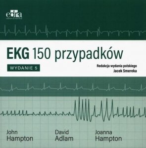 EKG 150 przypadków 