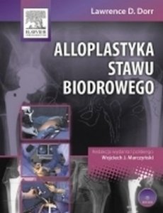 Alloplastyka stawu biodrowego /Elsevier