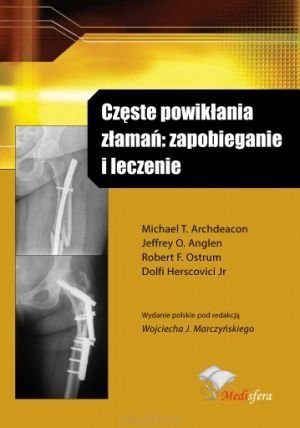 Częste powikłania złamań zapobieganie i leczenie