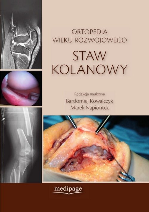 Ortopedia wieku rozwojowego Staw kolanowy