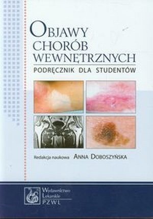 Objawy chorób wewnętrznych Podręcznik dla studentów