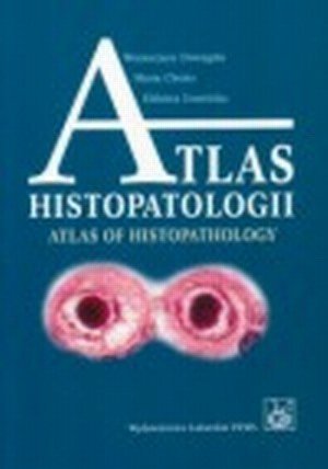 Atlas histopatologii Tajemniczy świat chorych komórek człowieka