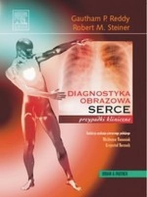 Serce Seria Diagnostyka Obrazowa Przypadki Kliniczne