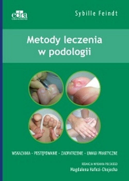 Metody leczenia w podologii