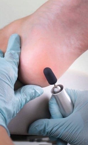 Kapturki ścierne na frez do pedicure 16mm gradacja 150 10 szt