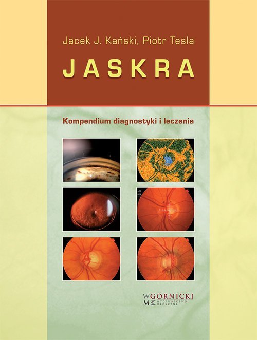 Jaskra Kompendium diagnostyki i leczenia