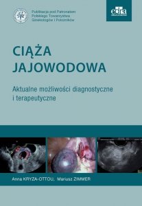 Ciąża jajowodowa Aktualne możliwości diagnostyczne i terapeutyczne