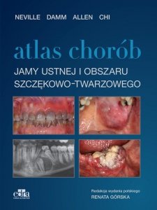 Atlas chorób jamy ustnej i obszaru szczękowo-twarzowego