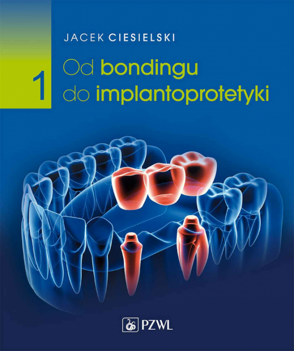 Od bondingu do implantoprotetyki. Cz. 1