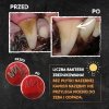 QCHEFS 2w1 Dental Charcoal CAT dla kota