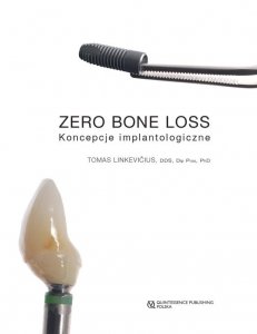 Zero Bone Loss - Koncepcje implantologiczne 