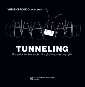 TUNNELING Kompleksowa koncepcja chirurgii plastycznej przyzębia 