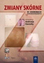 Zmiany skórne w chorobach ogólnoustrojowych. Tom 1