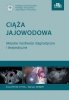 Ciąża jajowodowa Aktualne możliwości diagnostyczne i terapeutyczne 