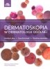 Dermatoskopia w dermatologii ogólnej 