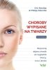 Choroby wypisane na twarzy 