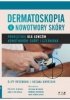 Dermatoskopia i nowotwory skóry. Podręcznik dla łowców nowotworów skóry i czerniaka 