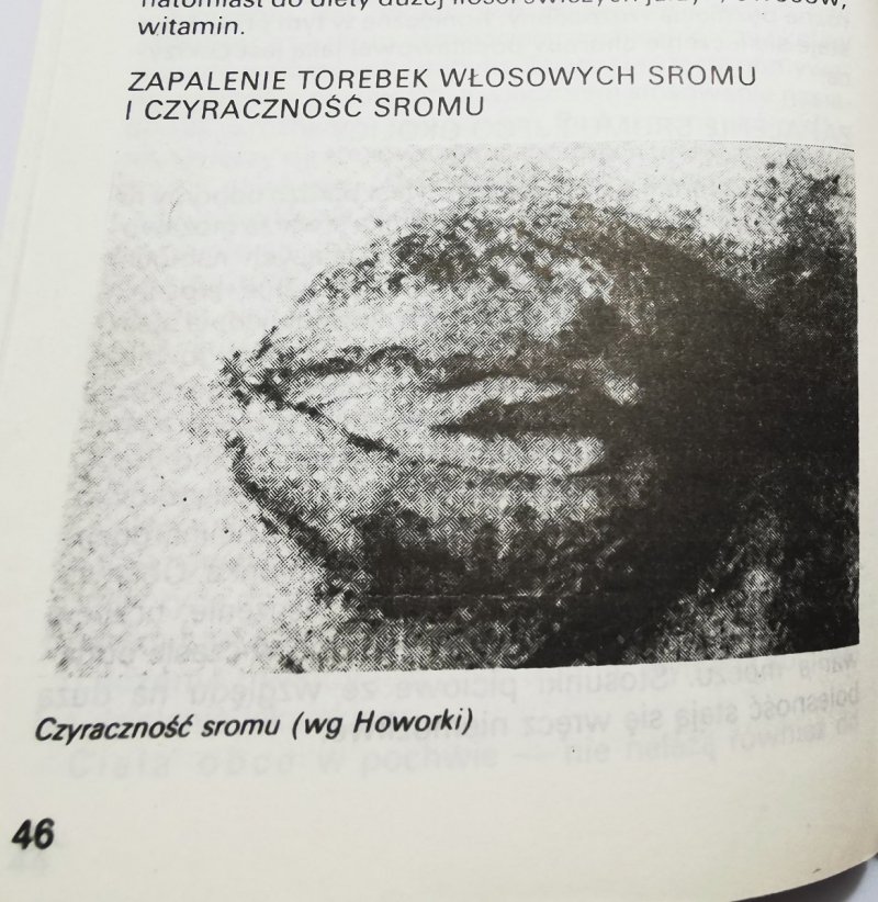 MIŁOŚĆ MŁODOŚĆ SEKS - Bohdan Trzeciak 1988