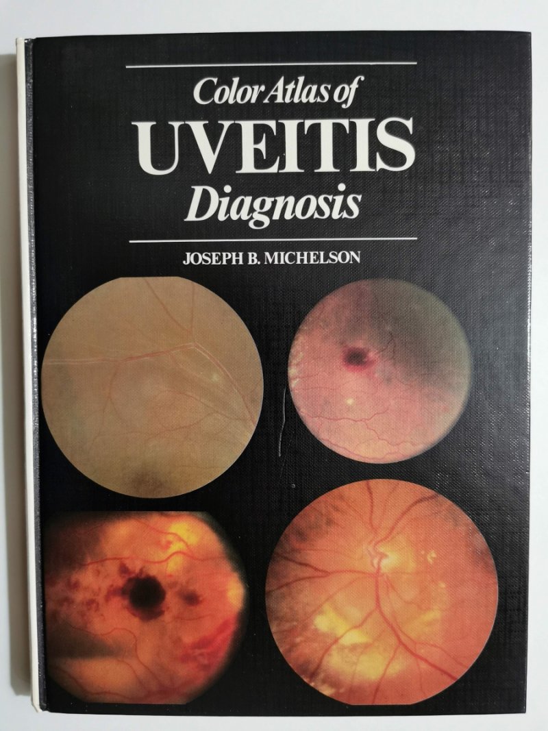 COLOR ATLAS OF UVEITIS DIAGNOSIS - Joseph B. Michelson
