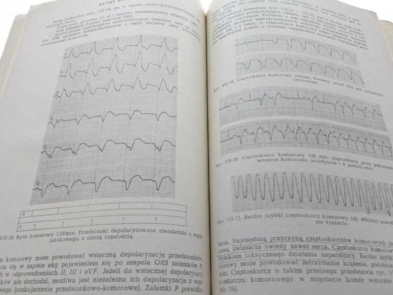 DIAGNOSTYKA ELEKTROKARDIOGRAFICZNA - Aleksandrow