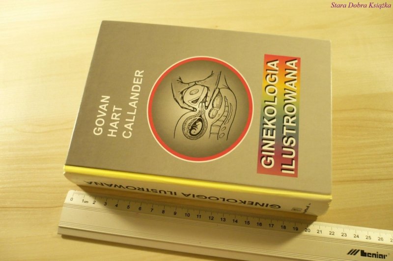 GINEKOLOGIA ILUSTROWANA  Govan Hart Callander 1995