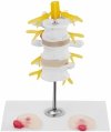 Odcinek lędźwiowy z przepukliną kręgosłupa - model anatomiczny Physa  PHY-SM-6 10040324 4062859971579
