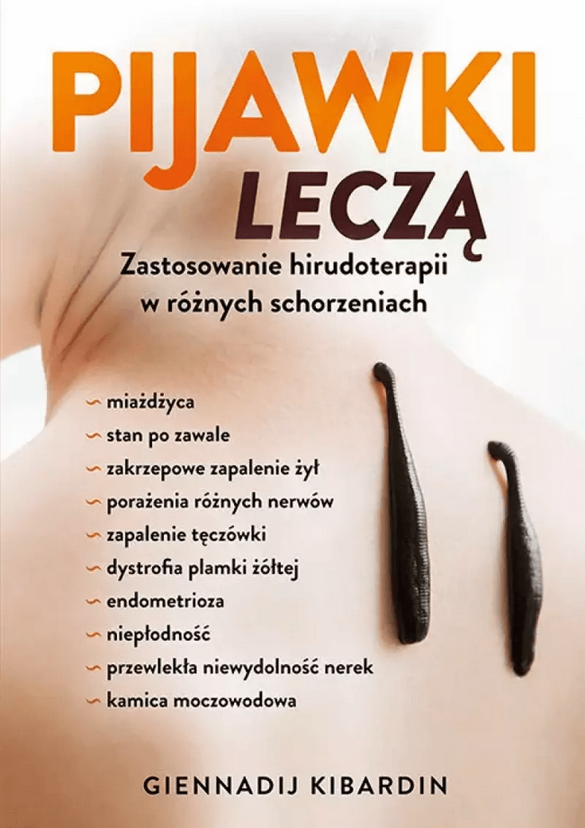  Pijawki leczą. Zastosowanie hirudoterapii w różnych schorzeniach